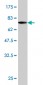 ERCC2 Antibody (monoclonal) (M04)