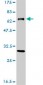 ERCC2 Antibody (monoclonal) (M04)