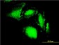 ERN1 Antibody (monoclonal) (M02)