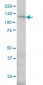 ERN1 Antibody (monoclonal) (M02)