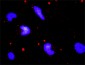 ERN1 Antibody (monoclonal) (M02)