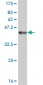 ERN1 Antibody (monoclonal) (M06)