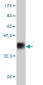 ESM1 Antibody (monoclonal) (M02)