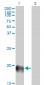 ESM1 Antibody (monoclonal) (M02)