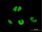 ESR2 Antibody (monoclonal) (M01)