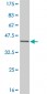 ESR2 Antibody (monoclonal) (M01)