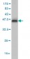 ETV1 Antibody (monoclonal) (M01)