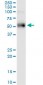 ETV1 Antibody (monoclonal) (M01)