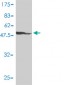 ETV4 Antibody (monoclonal) (M01)