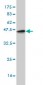 ETV5 Antibody (monoclonal) (M02)