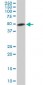 ETV5 Antibody (monoclonal) (M02)