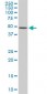 ETV5 Antibody (monoclonal) (M02)