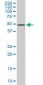 ETV5 Antibody (monoclonal) (M02)