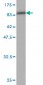 ETV6 Antibody (monoclonal) (M01)