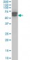 ETV6 Antibody (monoclonal) (M01)