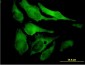 EYA2 Antibody (monoclonal) (M04)