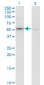 F11 monoclonal antibody (M01), clone 2H8