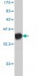F12 Antibody (monoclonal) (M01)