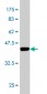 FABP1 Antibody (monoclonal) (M02)