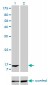 FABP1 Antibody (monoclonal) (M02)