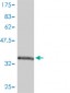 FABP3 Antibody (monoclonal) (M01)