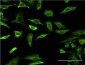 FABP4 Antibody (monoclonal) (M05)