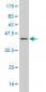 FABP4 Antibody (monoclonal) (M05)