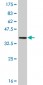 FABP4 Antibody (monoclonal) (M06)