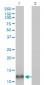 FABP4 Antibody (monoclonal) (M06)