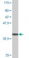 FADS1 Antibody (monoclonal) (M04)