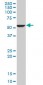 FADS1 Antibody (monoclonal) (M04)