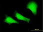 FANCC Antibody (monoclonal) (M01)