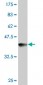 FANCC Antibody (monoclonal) (M01)