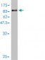 FANCG Antibody (monoclonal) (M01)