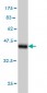 FARSLB Antibody (monoclonal) (M01)