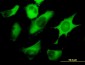 FASN Antibody (monoclonal) (M01)