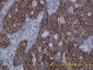 FASN Antibody (monoclonal) (M01)