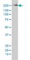 FASN Antibody (monoclonal) (M01)