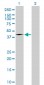 FASN Antibody (monoclonal) (M01)