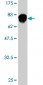 FASN Antibody (monoclonal) (M03)