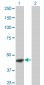 FASN Antibody (monoclonal) (M03)