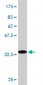 FBLIM1 Antibody (monoclonal) (M03)