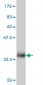 FBLIM1 Antibody (monoclonal) (M10)