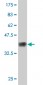 FBN1 Antibody (monoclonal) (M01)