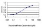 FBXL10 Antibody (monoclonal) (M09)