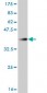 FBXL3 Antibody (monoclonal) (M01)