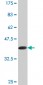 FBXL3 Antibody (monoclonal) (M03)