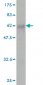 FBXO22 Antibody (monoclonal) (M01)