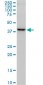 FBXO22 Antibody (monoclonal) (M01)