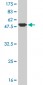 FCER1A Antibody (monoclonal) (M01)